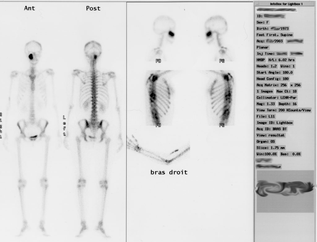 Medycyna Nuklearna Diagnostyka Sp Z Oo Kutno Łódzkie 2657